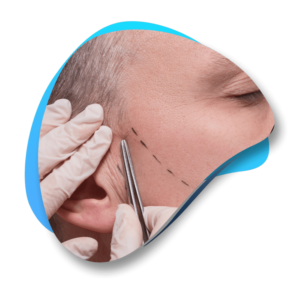 GREFFE DE BARBE TURQUIE