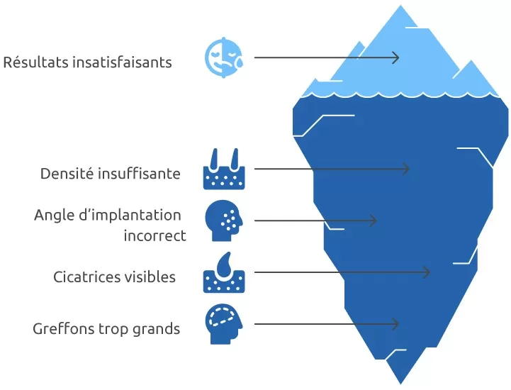 Greffe de Barbe Raté